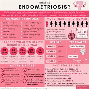 What Is Endometriosis A Summary Of Common Symptoms Statistics