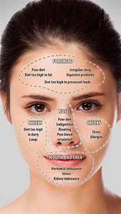 Acne Quot Chart Quot Learnmoreaboutskincare Skin Face Mapping Acne Skin
