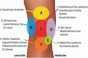 Knee Diagnosis Chart Betahealthy
