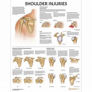 Shoulder Injuries Poster Upper Limb Injury Chart Dislocation Fracture