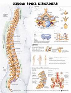 The Human Spine Disorders Chart Medwest Medical Supplies