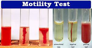 Motility Test Objectives Principle Procedure Results Limitation