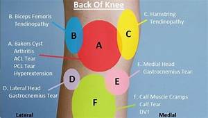 Posterior Knee Diagnosis Chart This Knee Injury Chart Helps