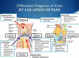 The 5 Must Know Ws About A Knee For Running