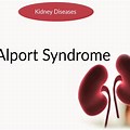 Alport Syndrome