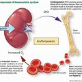 Anemia Chronic