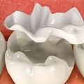 Ceramic