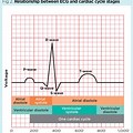 Cardiac Cycle