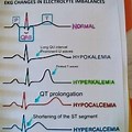 Electrolyte Imbalance