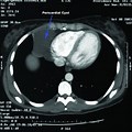MRI Radiology