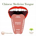 Traditional Chinese Medicine Tongue Diagnosis