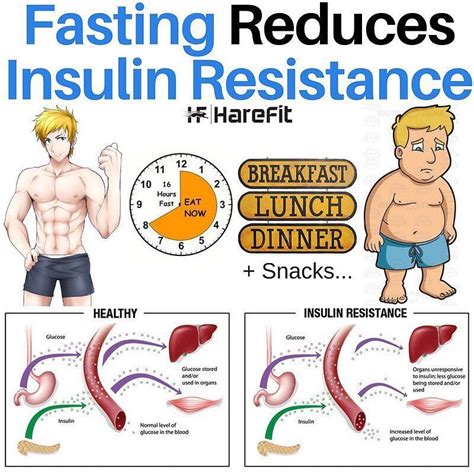 Intermittent Fasting and Insulin Resistance