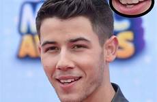 jonas nick teeth never brothers famous crazy noticed thing celebrities choose board seventeen
