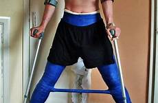 body cast spica hip double man bar spreader leg blue casts shoulder broken tumblr