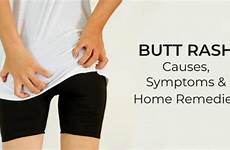 rash butt anal symptoms skin adult chafing running remedies rashes itchy health painful causes posting procedures