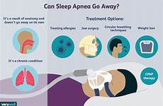 apnea snoring remedies schlafapnoe obstructive throat ursachen prognosis final2 gary ferster verywell verywellhealth