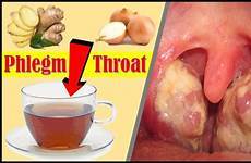 throat mucus phlegm clear remedy remedies
