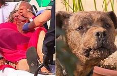 attacked dog woman hospital being her after injuries rushed comments serious own