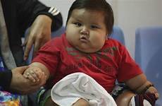obese baby santiago mendoza old child fat obesity morbidly month toddlers weighs lose weight year who toddler 42lb eight do