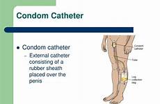 catheter condom urinary external ppt placed system powerpoint presentation penis sheath consisting rubber over