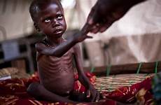 hungry africans sudan malnutrition so many child why south feeding nuba refugee yida severe mountains signs shows center