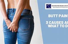 pain butt causes top buttock do