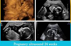 pregnancy 24 week weeks ultrasound 24th mother