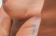 melanie thefappening scar surgically