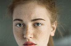 freckles girl portrait beautiful stocksy perfect
