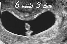 weeks ultrasound pregnant week six symptoms expect pregnancy baby spotting cramping submit click ultrasounds sixth find