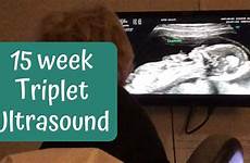 ultrasound triplet