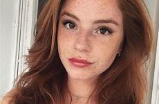 freckles redheads potter roux sommersprossen haare rote tolle rousses beaux hollestelle lovestories liebestest lovestory magnifiques visitar rousse visages zdroj pinu