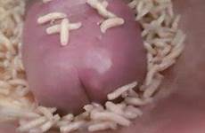 maggots maggot cock fetish videos thisvid tag worms month likes ago 2072
