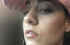 injuries dog facial her attack star she nose paola saulino revealing bandage removed poses another sex suffered reveals across