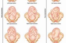 nursing fetal womb midwifery mother uterus midwife breech obgyn