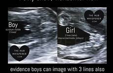 ultrasound nub fetus predict determination womb