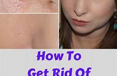 pores rid large face remedies naturally close tighten skin clean help them open keep which will