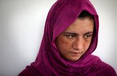 afghan girl tortured justice sahar wed finds rare afghanistan women girls sex gul beaten safe beat old young her bulldog