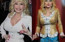 dolly parton surgery plastic breast before then now liposuction after did implants weight had singer loss choose board