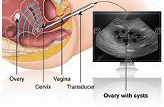 ultrasound transvaginal checkup background witte ultrasone achtergrond medische
