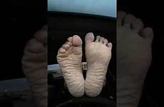 wrinkled soles feet