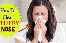 nose stuffy nasal congestion instantly