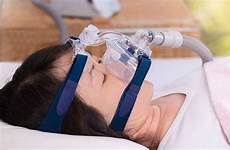 sleep apnea treatment obstructive deep easton pa massapequa devices disrupts ongoing condition oral patient attleborough swansea