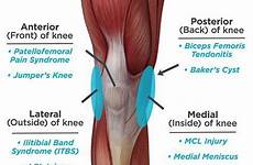knee pain posterior anterior medial lateral common anatomy does causes types injury why hurt back muscles swelling injuries sports top