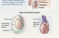 testicular jama swelling anatomy masses hernia scrotal jamanetwork