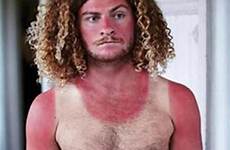 heatwave fails viral sun snap cringeworthy snaps awkward worst disasters show sunburn