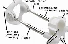 proextender extender penis penile device extenders rods shop straightening