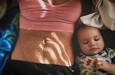parto pregnancy corpo gravidez pós donne barriga embarazo flácida embarazos animar madres sentirse guapas após mães maternidade