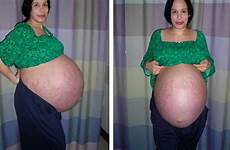 suleman octomom nadya belly babies baby pregnancy did her