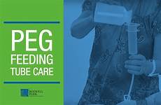 peg tube feeding care patient instructions education